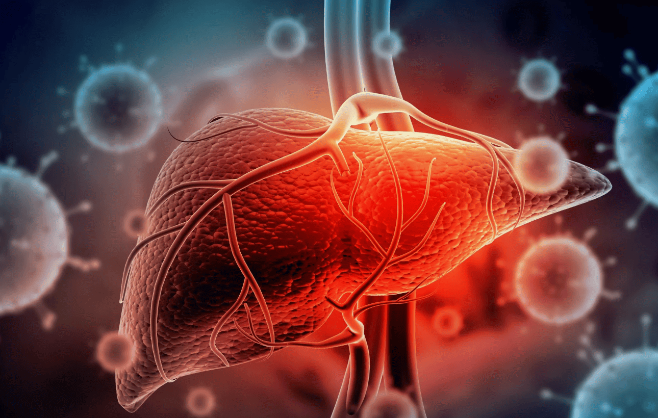 Классификация HCV и формулирование диагноза